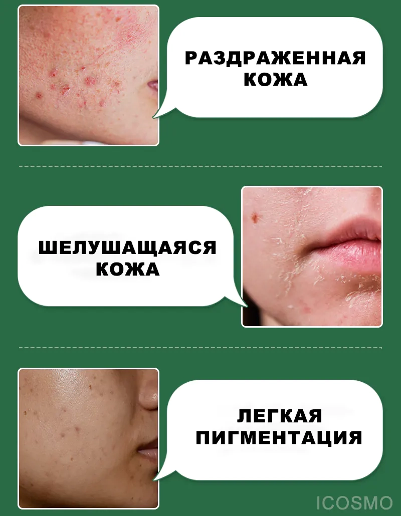 В каких случаях применять сыворотку MEDI PEEL AHA BHA Amino Cica-Nol B5 Ampoule