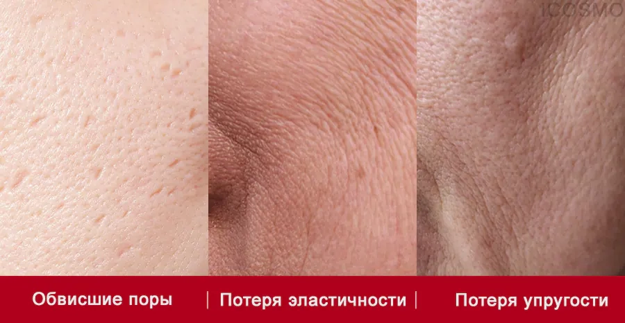 Для какой кожи подходит серия продуктов Medi Peel Red Lacto Peptide Collagen