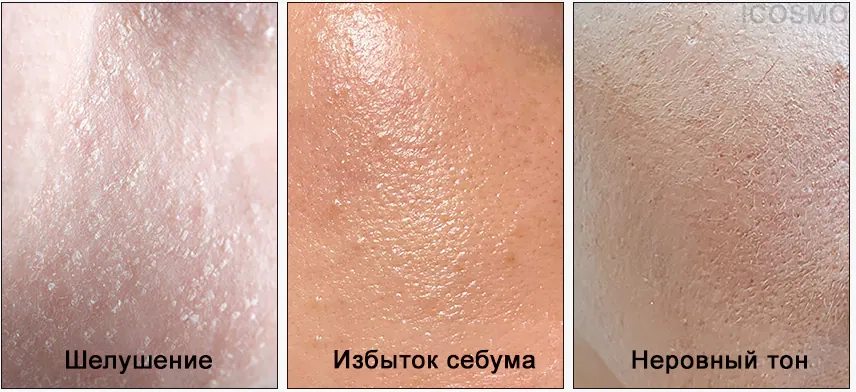 Для какой кожи подходит пилинг-гель Medi Peel Red Lacto Collagen Konjac Peeling Gel