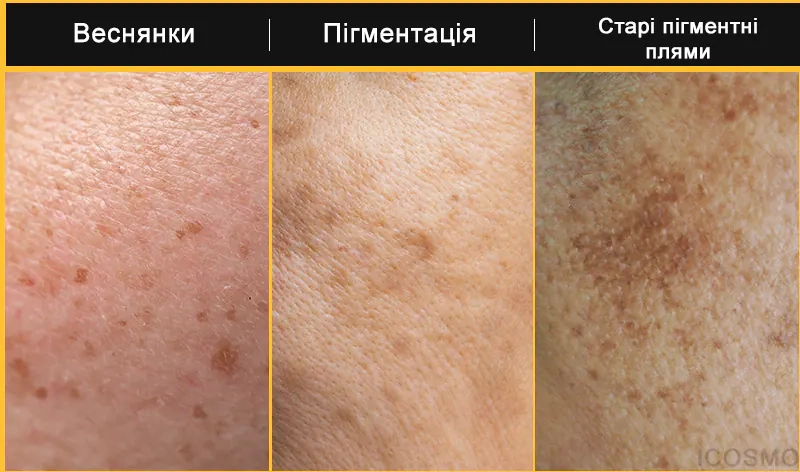 Проблеми які вирішує серія продуктів Medi Peel Peptide 9 Vitanol