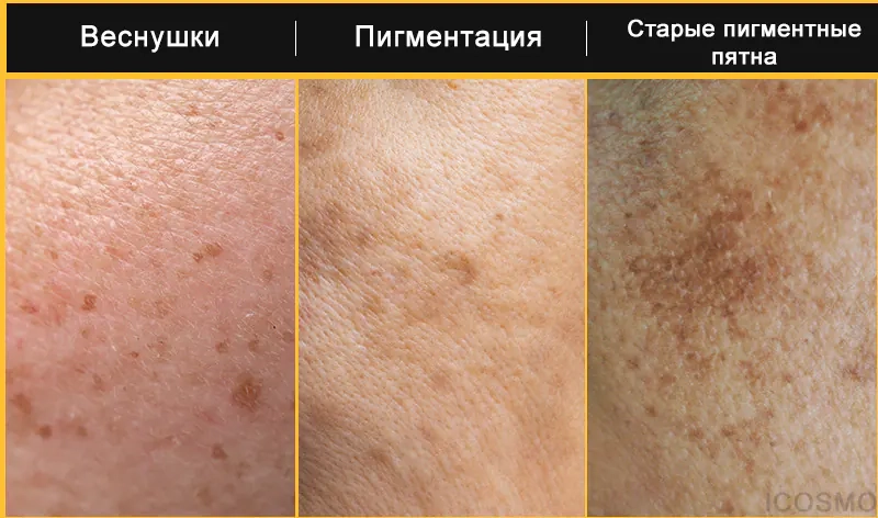 Проблемы кожи которые решает серия продуктов Medi Peel Peptide 9 Vitanol