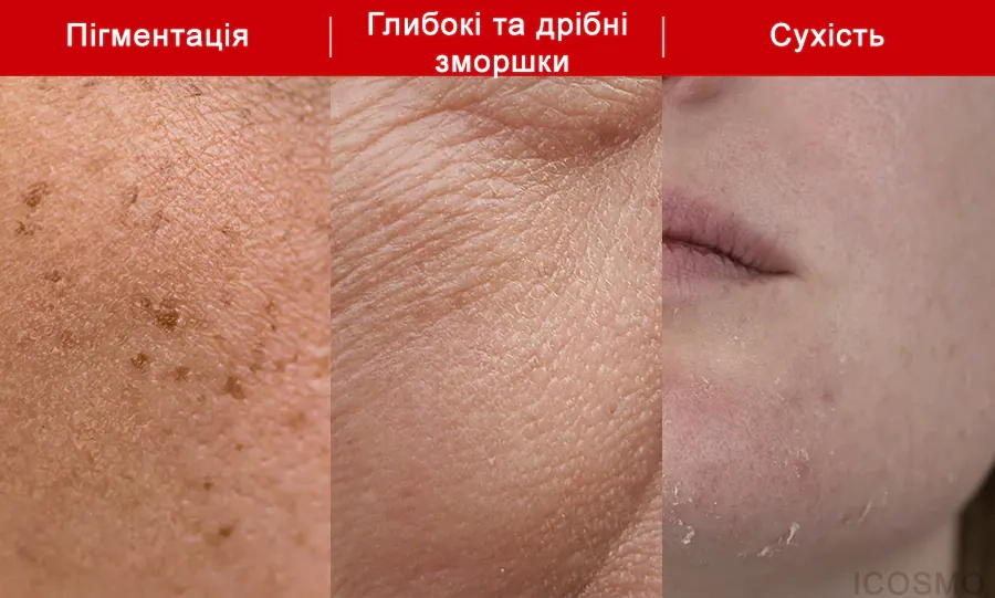 Для якої шкіри підходить серія Medi peel Melanon X