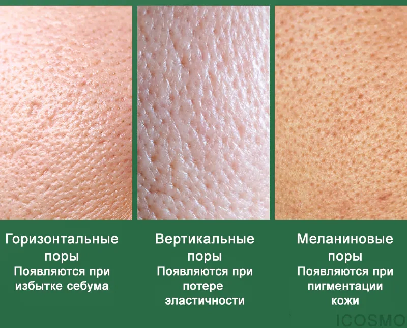 Разные поры которые устраняет крем Medi peel Phyto Cica-Nol B5 Calming Drop Gel Cream