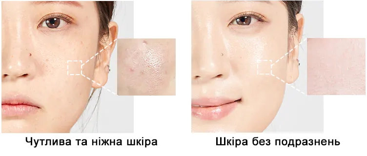 Шкіра після використання тонера Medi peel Phyto CICA-Nol B5 AHA BHA Vitamin Calming Toner