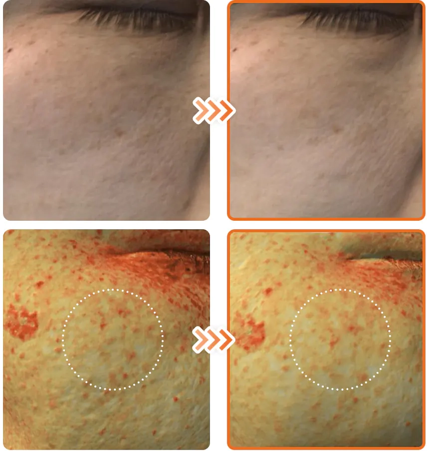 Уменьшение пигментации после сыворотки Dr. Althea Vitamin C Boosting Serum