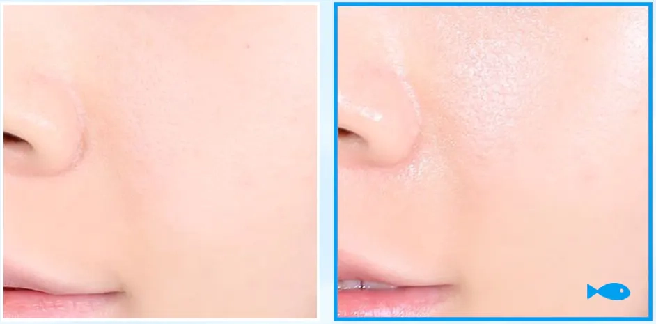 Шкіра після крему Medi peel Mooltox PDRN Hyal Drop Gel Cream