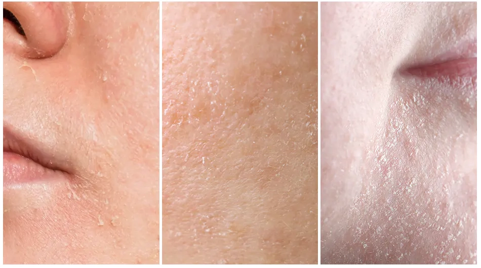 Для якої шкіри підходить крем Medi peel Mooltox PDRN Hyal Drop Gel Cream