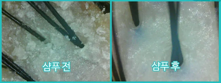 Кожа головы после шампуня SPAKLEAN Amazing Collagen Scalp Shampoo