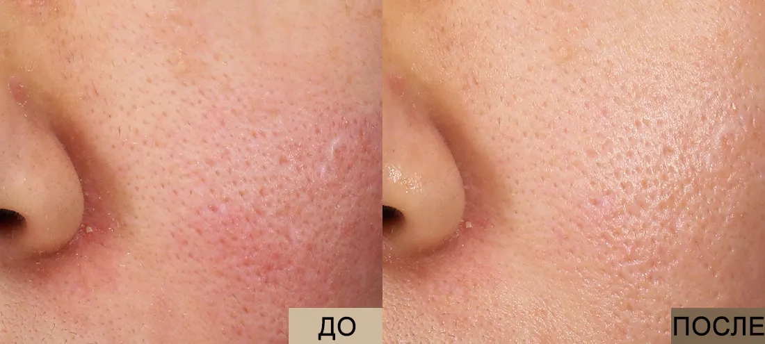 Успокаивающий эффект миста Dr. Althea 345 Relief Cream Mist