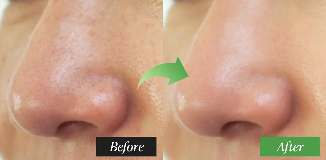 Результаты использования Dr. Althea Premium Quick Step Sebum Cleanser