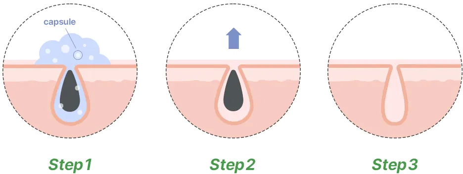 Процесс очищения пор средством Dr. Althea Premium Quick Step Sebum Cleanser