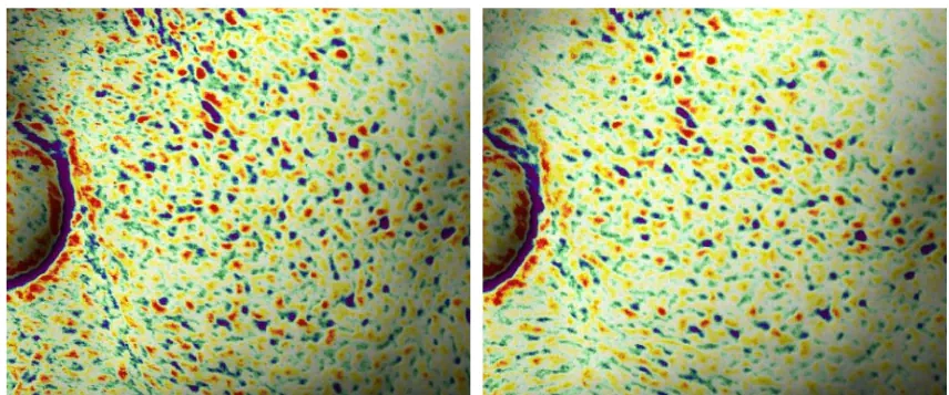 Улучшение текстуры кожи после пилинга AXIS-Y PHA Resurfacing Glow Peel