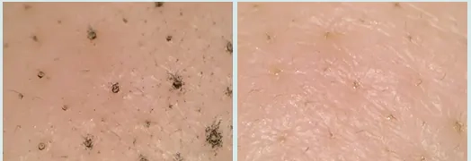 Очищення шкіри після ензимної пудри TOCOBO Cica Calming Powder Wash