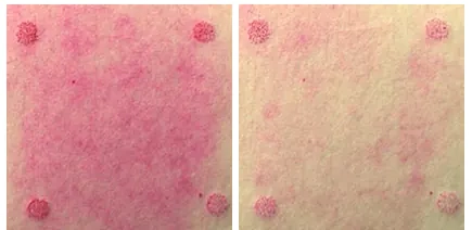 Успокаивающий эффект крема TOCOBO Cica Calming Gel Cream