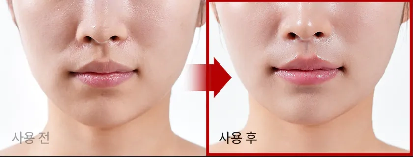 Лифтинг-эффект крема Medi peel Phyto Ex PDRN Lifting Shot Drop Gel Cream