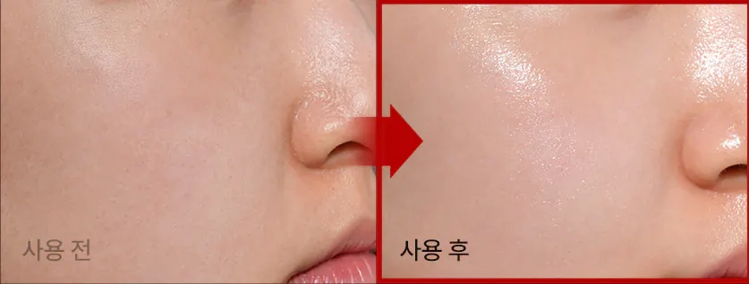 Эластичность кожи после крема Medi peel Phyto Ex PDRN Lifting Shot Drop Gel Cream