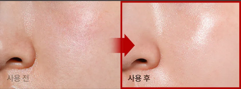 Сияние кожи после крема Medi peel Phyto Ex PDRN Lifting Shot Drop Gel Cream