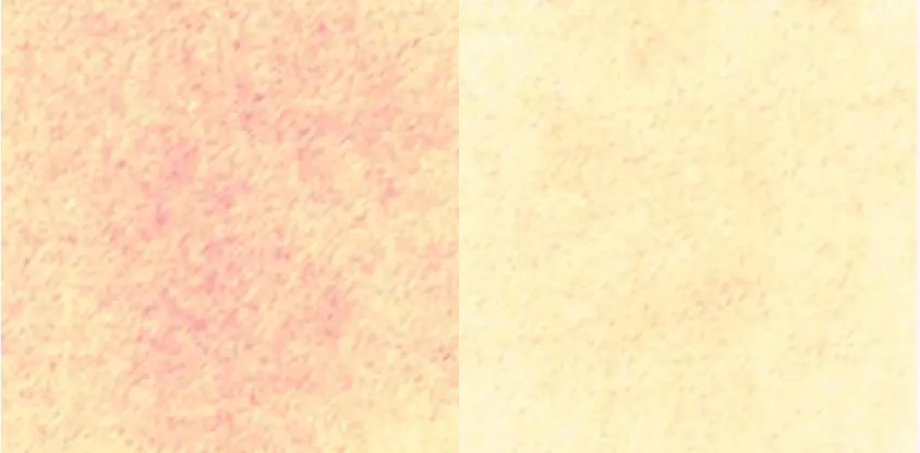 Заспокійливий ефект після крему APOTHE Exosome Squal-Tox Moisturizing Cream