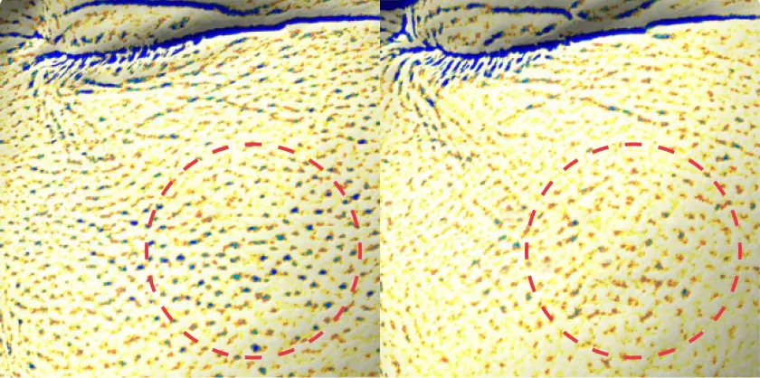 Ефект підтягуваня пор після крему APOTHE Exosome Squal-Tox Moisturizing Cream