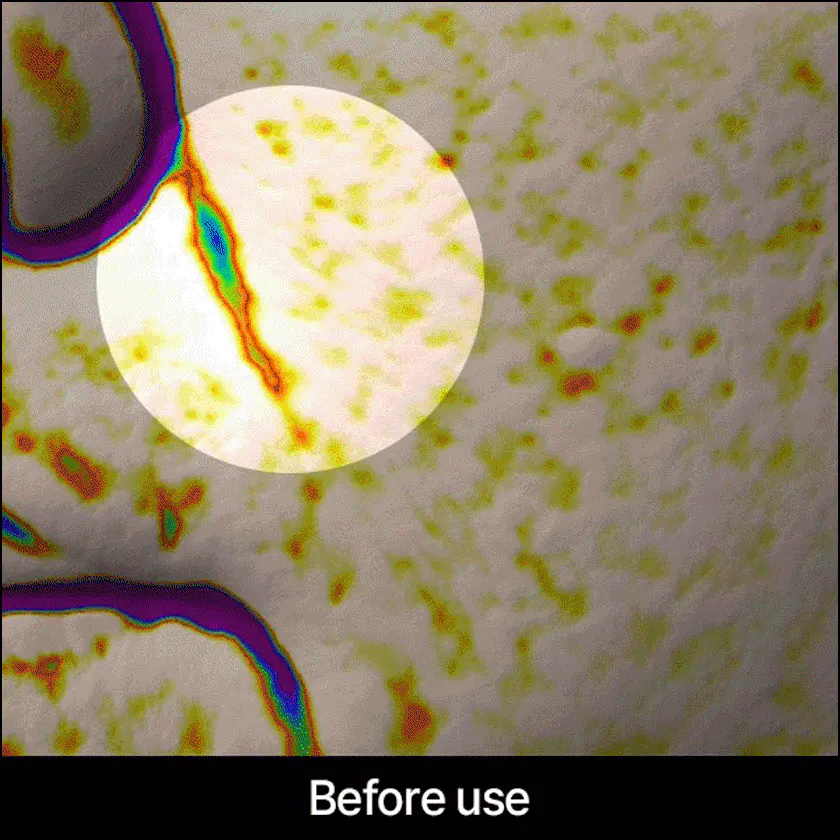 Покращення стану носогубних зморшок після маски APOTHE Red Capsule Pro-Collagen Lifting Mask