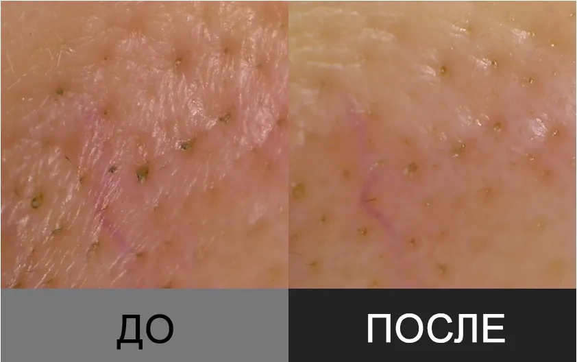 Пилинг-гель против черных точек APOTHE Baku-Kaol Brightening Scrub Cleanser
