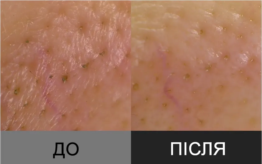 Пілінг-гель проти чорних цяток APOTHE Baku-Kaol Brightening Scrub Cleanser