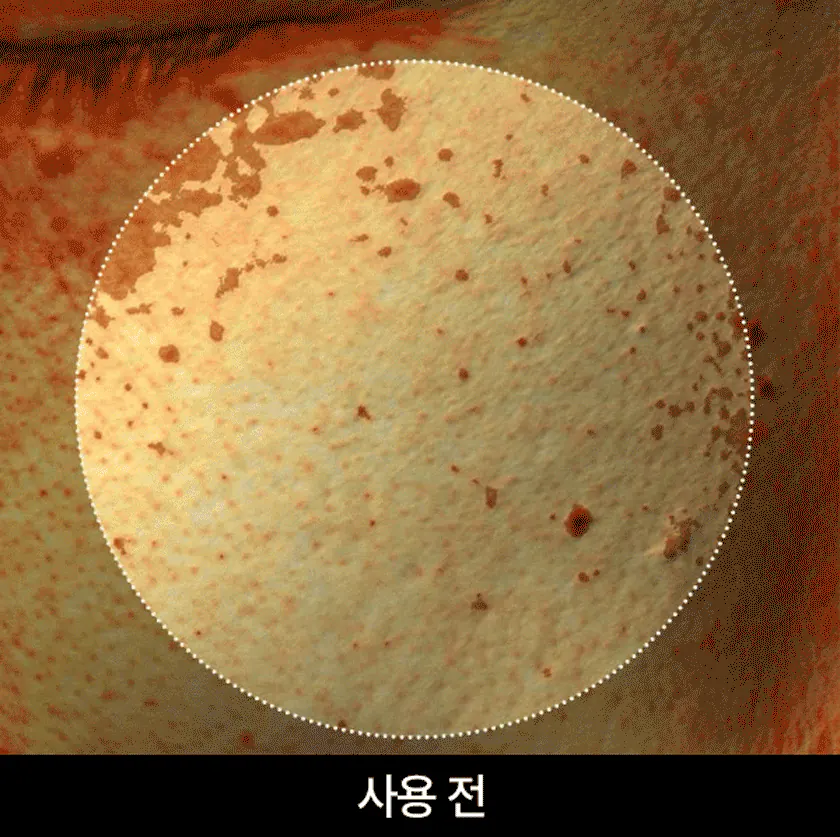 Осветление пигментации после сыворотки APOTHE Exosome Mela-Glu Dark Spot Ampoule