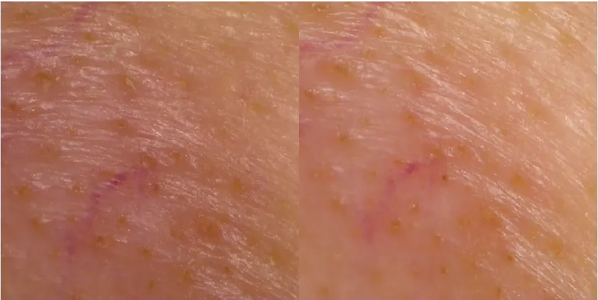 Очищение кожи пэдами APOTHE Exosome Anti-Pollution Toning Pad