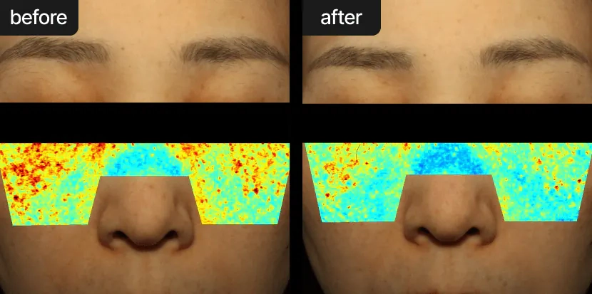 Зменшення вироблення меланіну після крему Celimax Pore+Dark Spot Brightening Cream