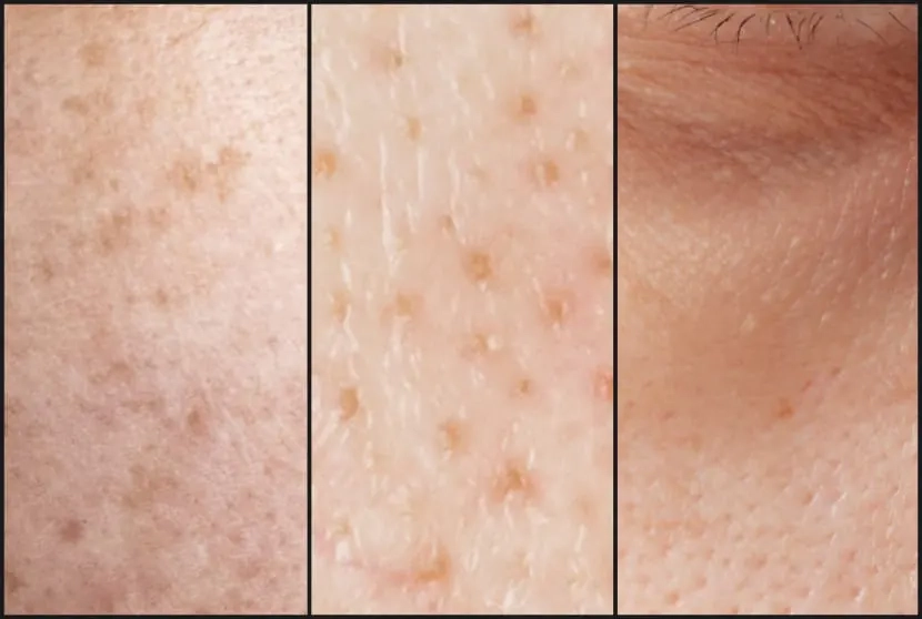 Проблеми, які вирішує крем Celimax Pore+Dark Spot Brightening Cream