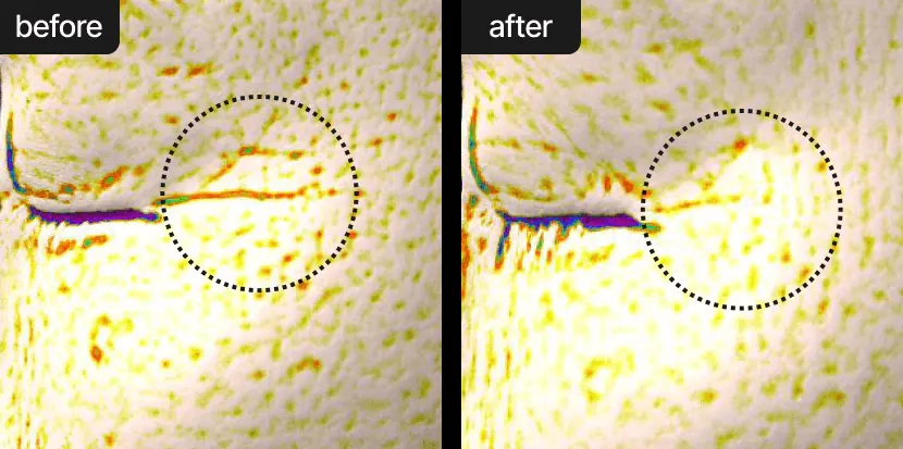 Зменшення мімічних зморшок після крему Celimax Pore+Dark Spot Brightening Cream