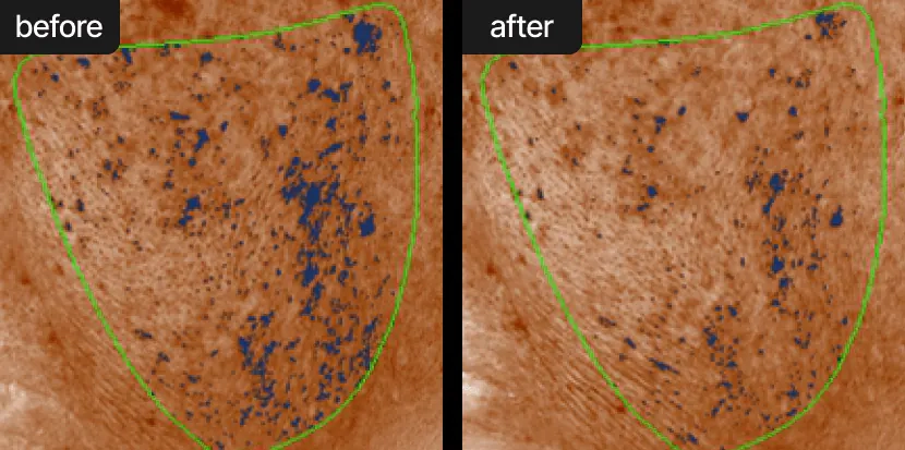 Зменшення пігментації після крему Celimax Pore+Dark Spot Brightening Cream