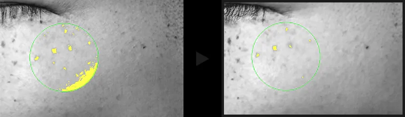 Зменшення пігментації після сироватки Celimax Pore+Dark Spot Brightening Serum