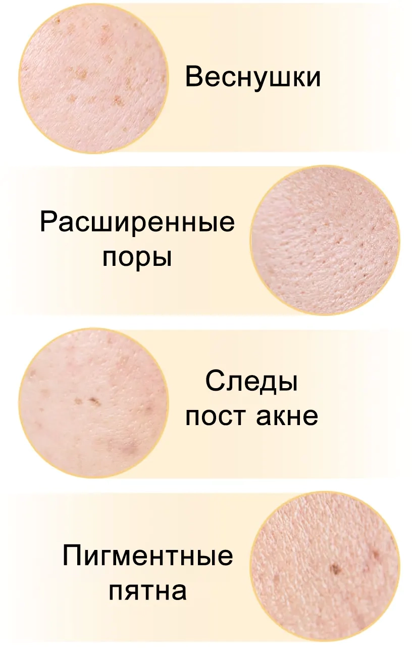 Проблемы, которые решает сыворотка Celimax Pore+Dark Spot Brightening Serum