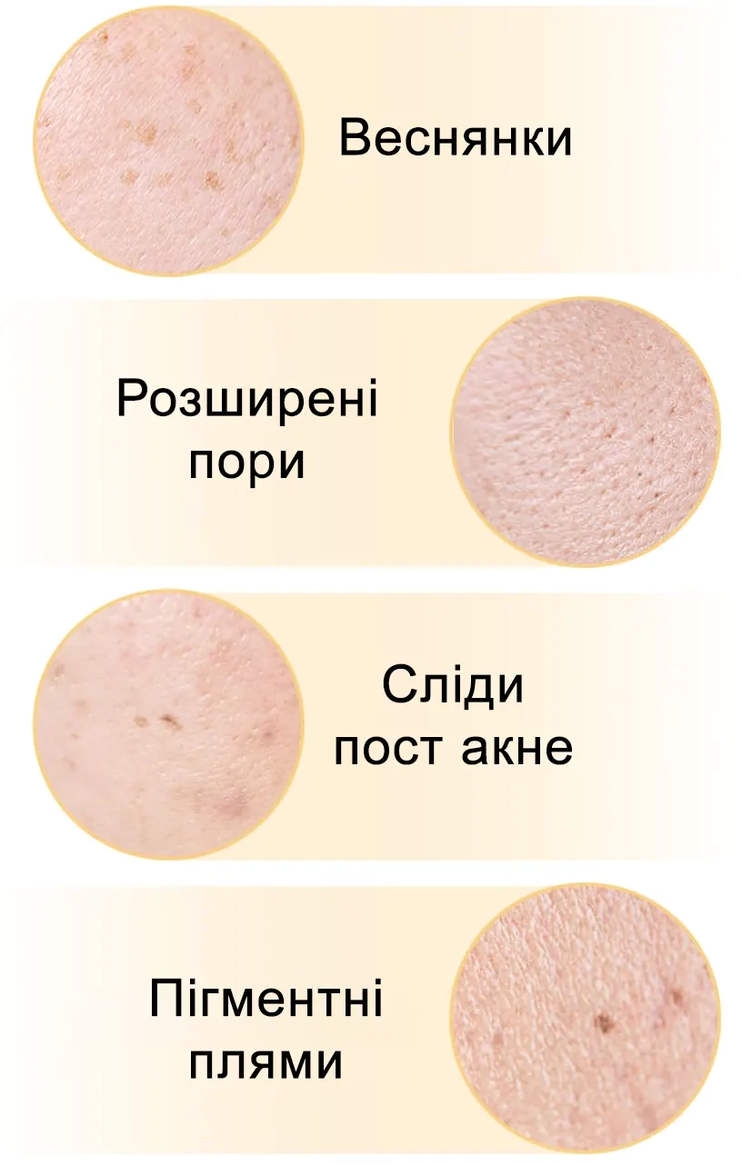 Проблеми, які вирішує сироватка Celimax Pore+Dark Spot Brightening Serum