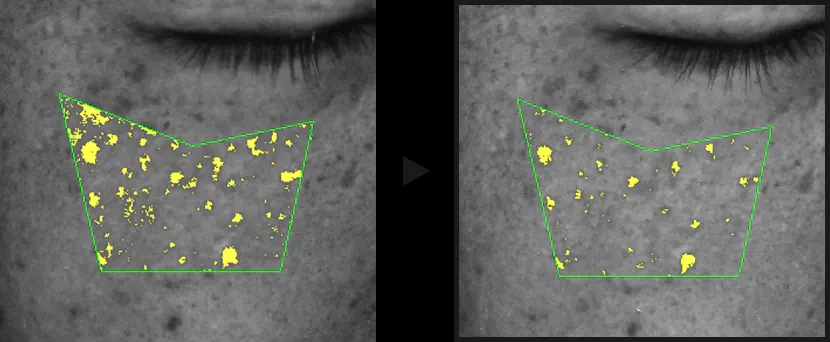Зменшення пор після сироватки Celimax Pore+Dark Spot Brightening Serum