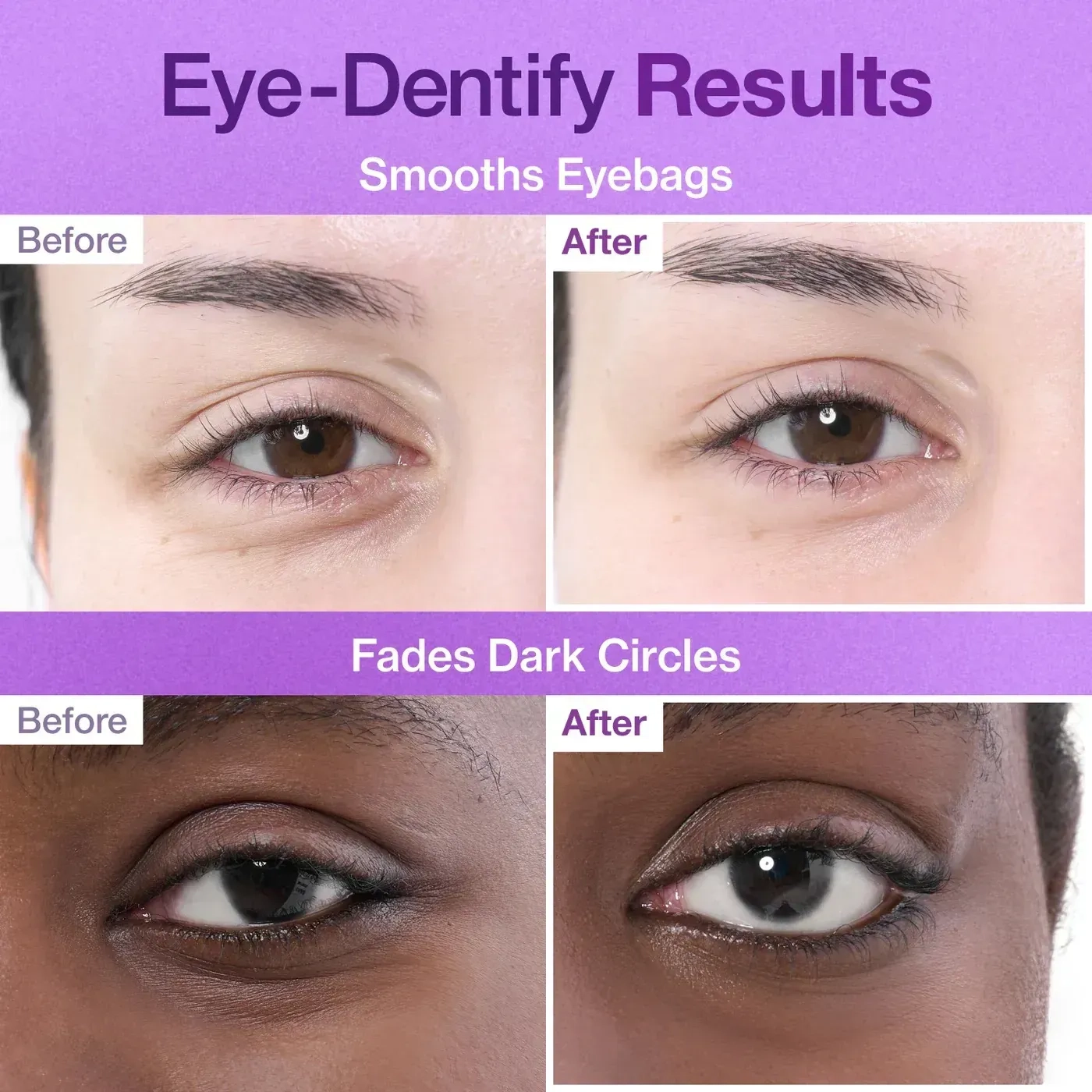 Патчі гідрогелеві ліфтинг під очі з колагеном та пептидами - NUMBUZIN No.9 NAD+ Collagen Under Eye Patches, 5 шт - фото N3