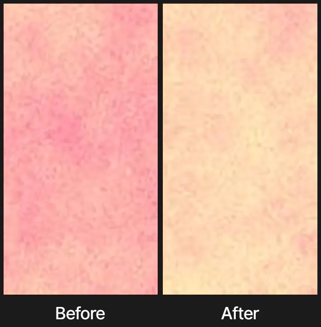 Успокаивающий эффект сыворотки Celimax Noni Energy Ampoule