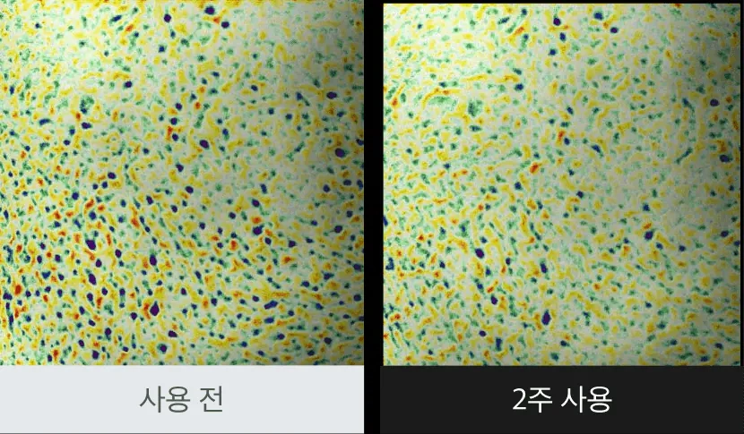 Улучшение текстуры кожи после сыворотки Celimax Noni Energy Ampoule