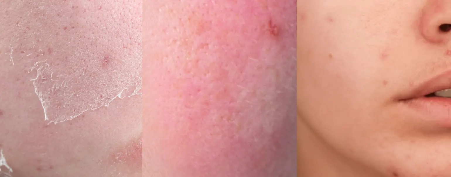 Коли слід використовувати крем Celimax Noni Energy Repair Cream