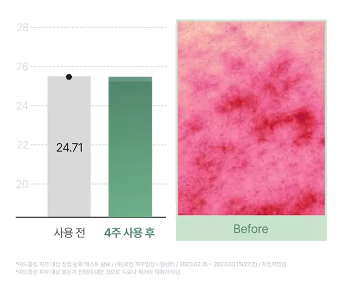 Заспокійливий ефект сироватки Celimax Cica Niacinamide AC Calming Serum