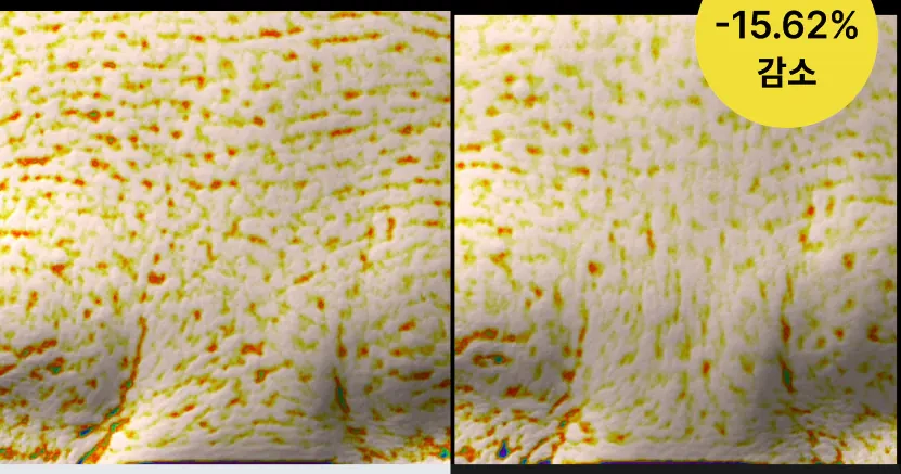 Улучшение морщин между бровей после Celimax The Vita-A Retinol Shot Tightening Serum