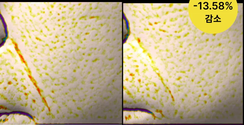 Улучшение носогубных морщин после Celimax The Vita-A Retinol Shot Tightening Serum