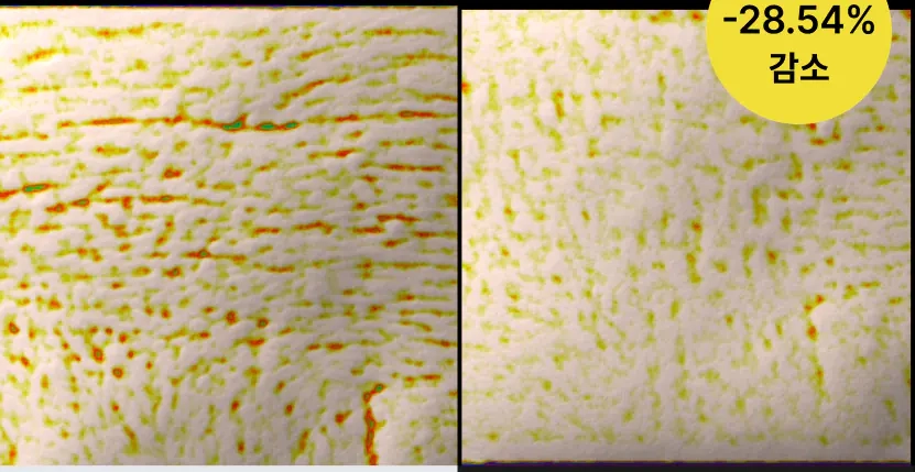 Улучшение состояния морщин после крема Celimax The Vita-A Retinal Shot Tightening Booster