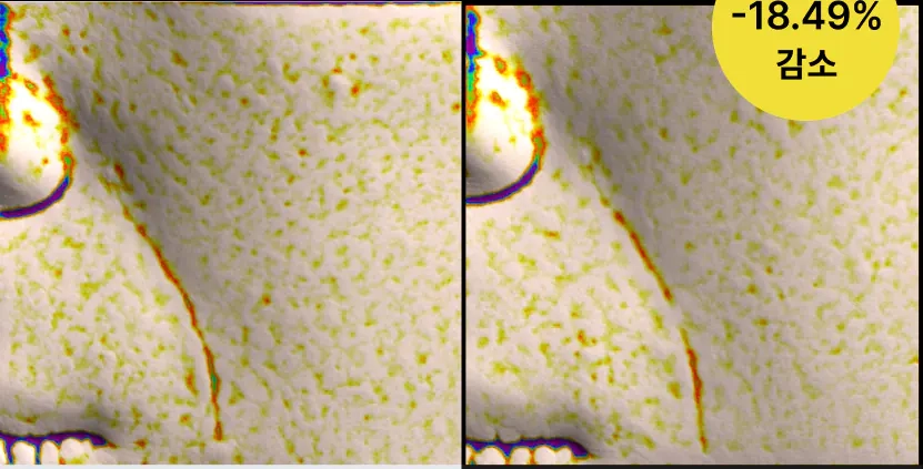 Улучшение носогубных морщин после крема Celimax The Vita-A Retinal Shot Tightening Booster