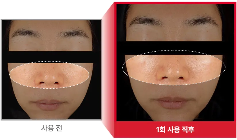 Сияющая кожа после пудры Medi peel Phyto EX PDRN Rice Powder Cleanser