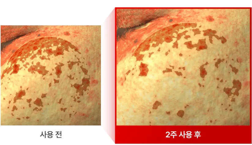 Зменшення пігментації після крему Medi peel Melanon X Cream 2.0