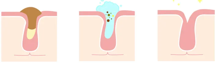 Очищение пор пенкой для умывания BEAUSTA Fresh Whipping Foam Cleanser