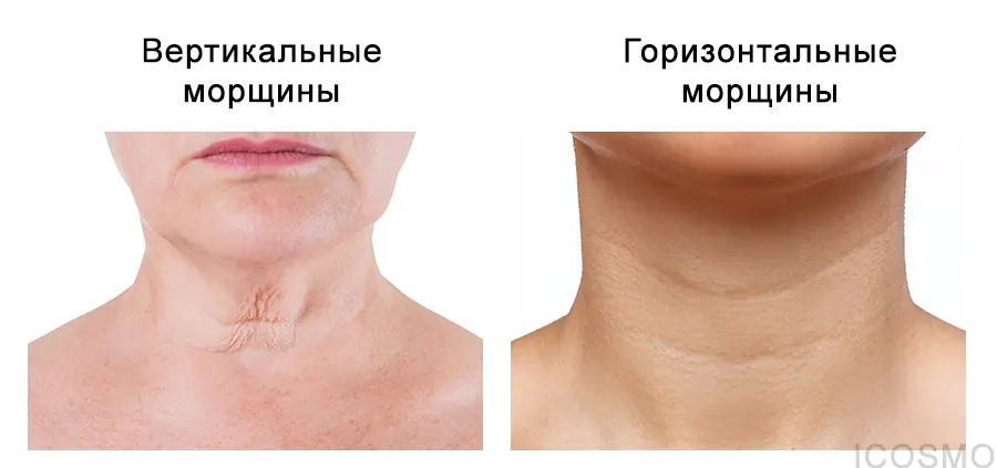 Подтягивающий крем для шеи и декольте против морщин с пептидами и коллагеном - Medi peel Premium Collagen Naite Thread Neck Cream 3.0, 100 мл - фото N6