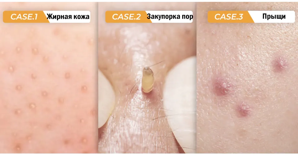 Для какой кожи предназначена серия NUMBUZIN No.1